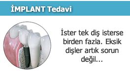 İmplant Diş Fiyatı